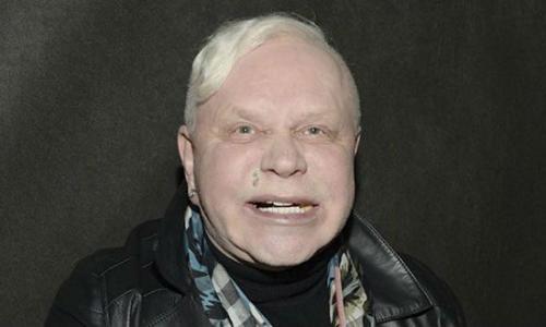 Ушел тихо и навсегда: Моисеев сломлен болезнью